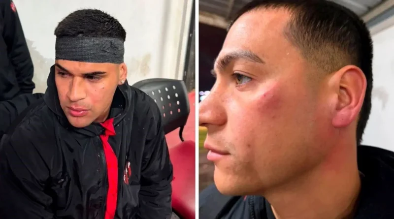 Hinchas de Patronato agredieron salvajemente a jugadores tras el regreso de Santa Fe
