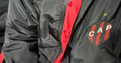 La Fiscalía y la Policía tienen pruebas tras la agresión y robo a jugadores de Patronato